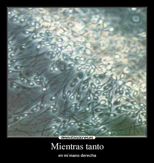 Mientras tanto - en mi mano derecha