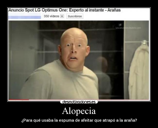 Alopecia - 