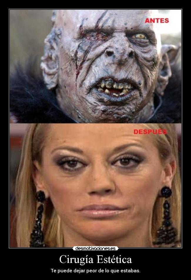 Cirugía Estética - Te puede dejar peor de lo que estabas.