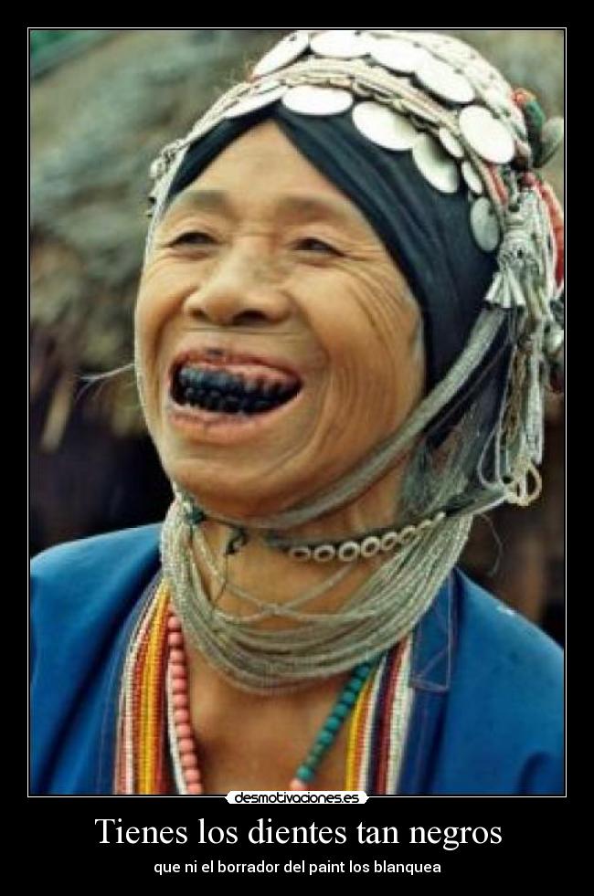 Tienes los dientes tan negros -