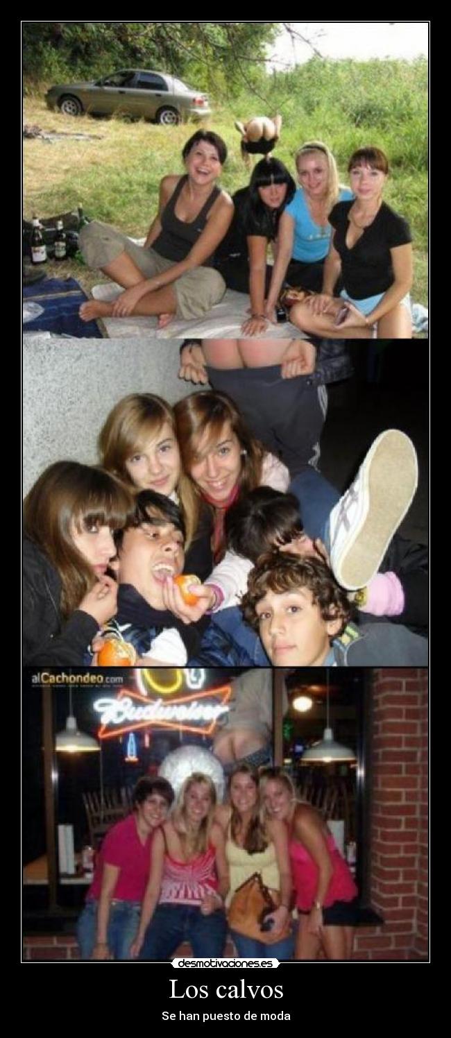 Los calvos - Se han puesto de moda