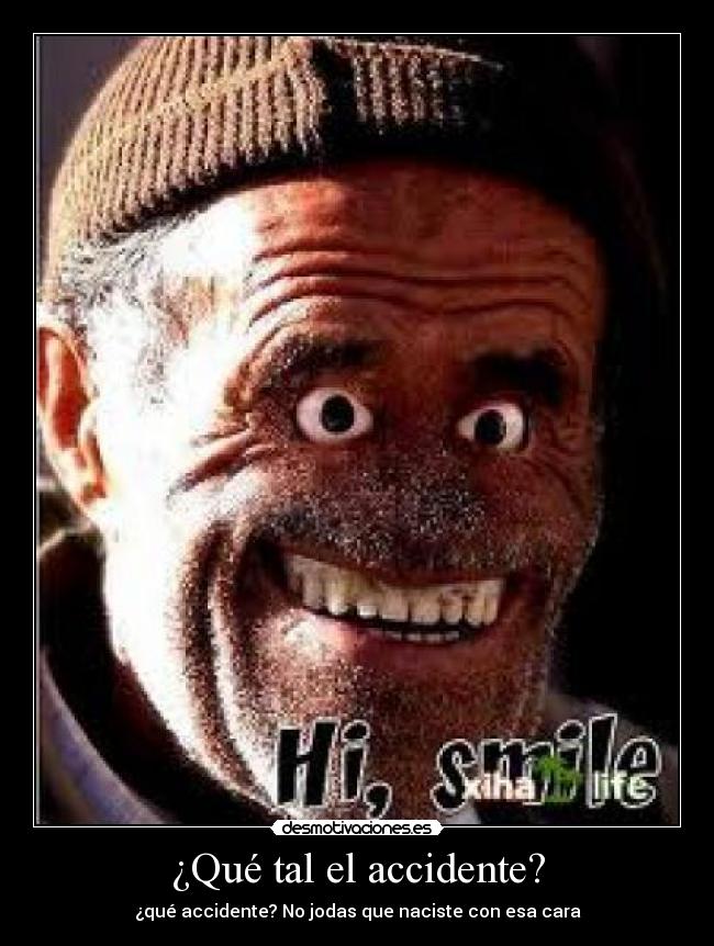 ¿Qué tal el accidente? -