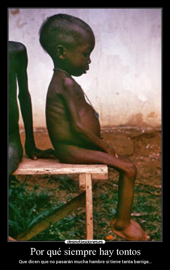 Por qué siempre hay tontos - Que dicen que no pasarán mucha hambre si tiene tanta barriga...