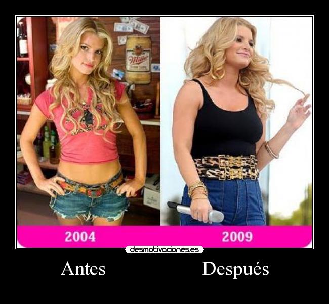 Antes                   Después - 