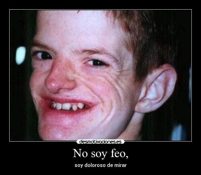 No soy feo, - 