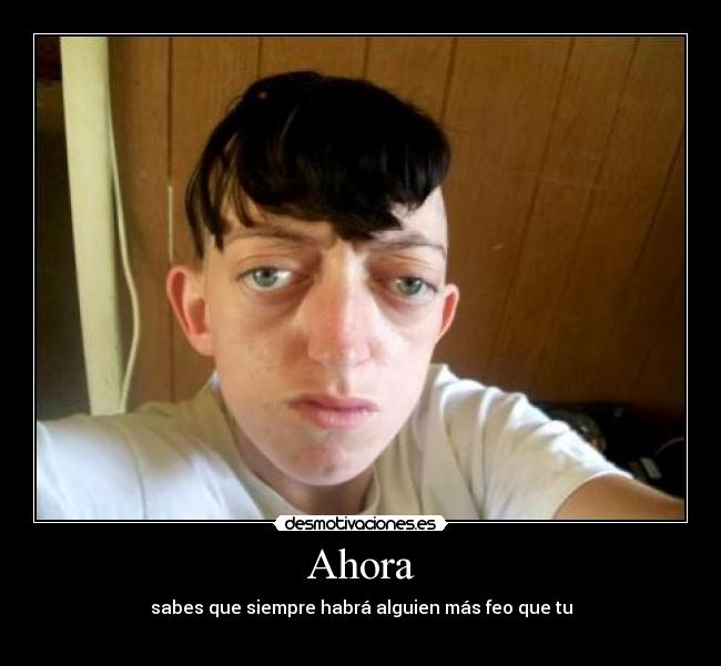 Ahora - sabes que siempre habrá alguien más feo que tu