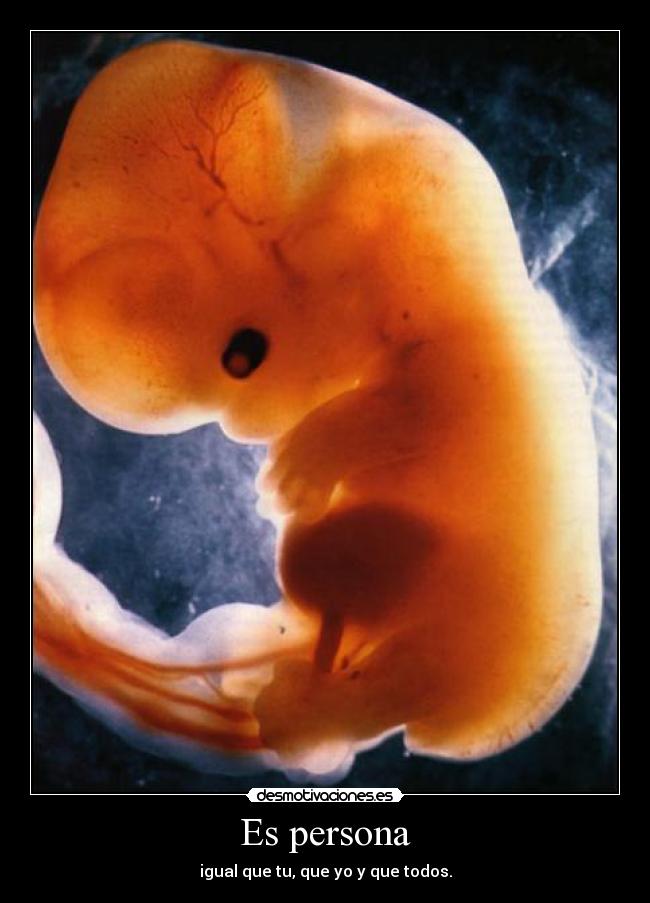 Es persona - 