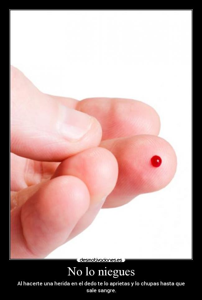 No lo niegues - Al hacerte una herida en el dedo te lo aprietas y lo chupas hasta que sale sangre.
