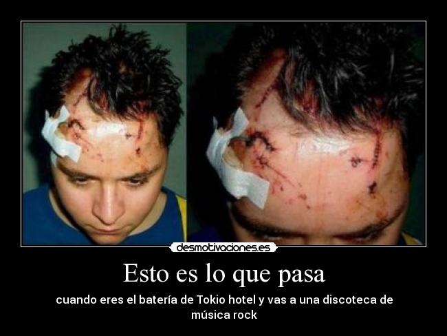 Esto es lo que pasa -