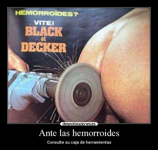 Ante las hemorroides -