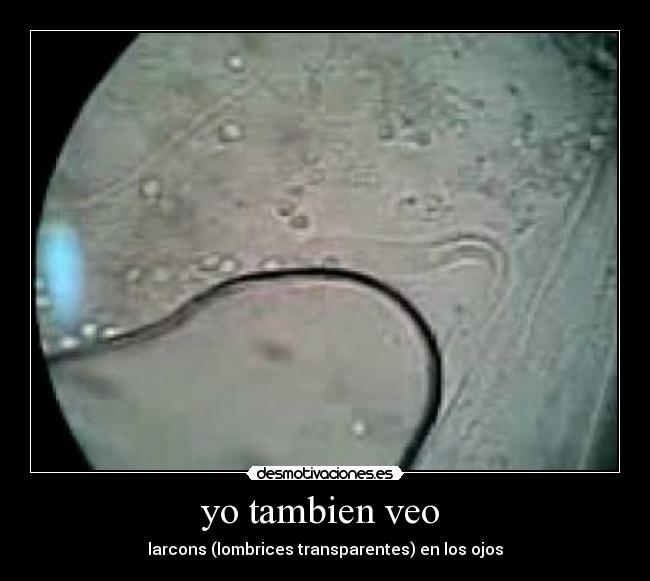 yo tambien veo  - 