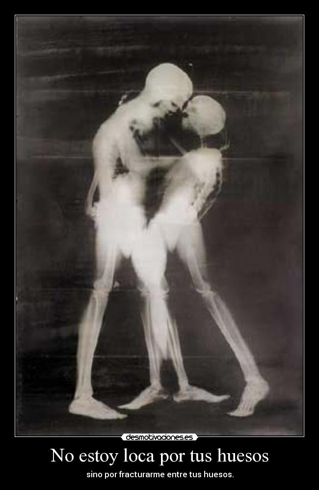 No estoy loca por tus huesos - sino por fracturarme entre tus huesos.