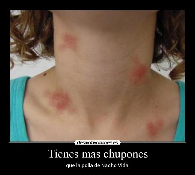 Tienes mas chupones - que la polla de Nacho Vidal