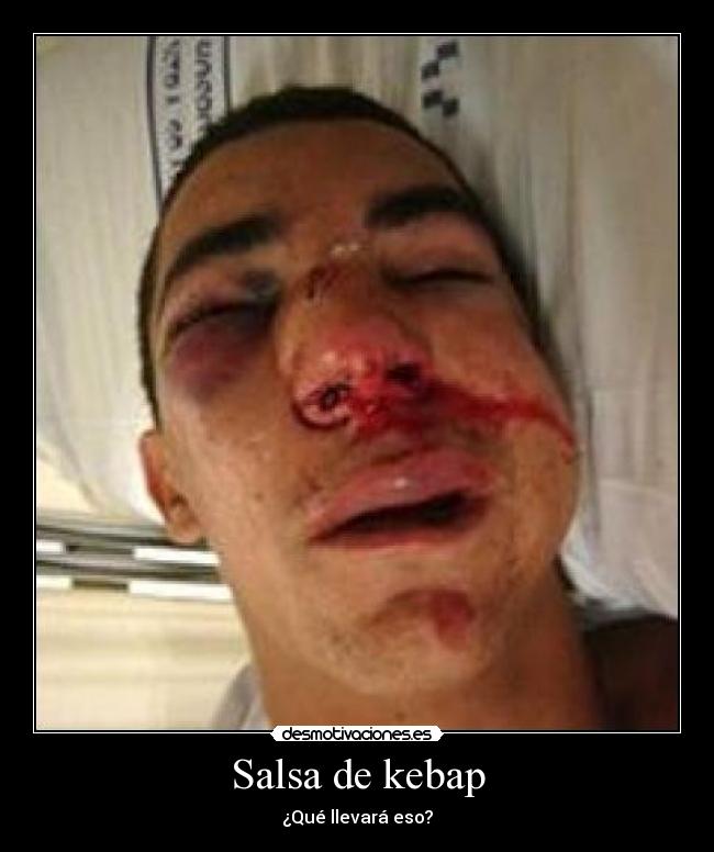 Salsa de kebap - ¿Qué llevará eso?