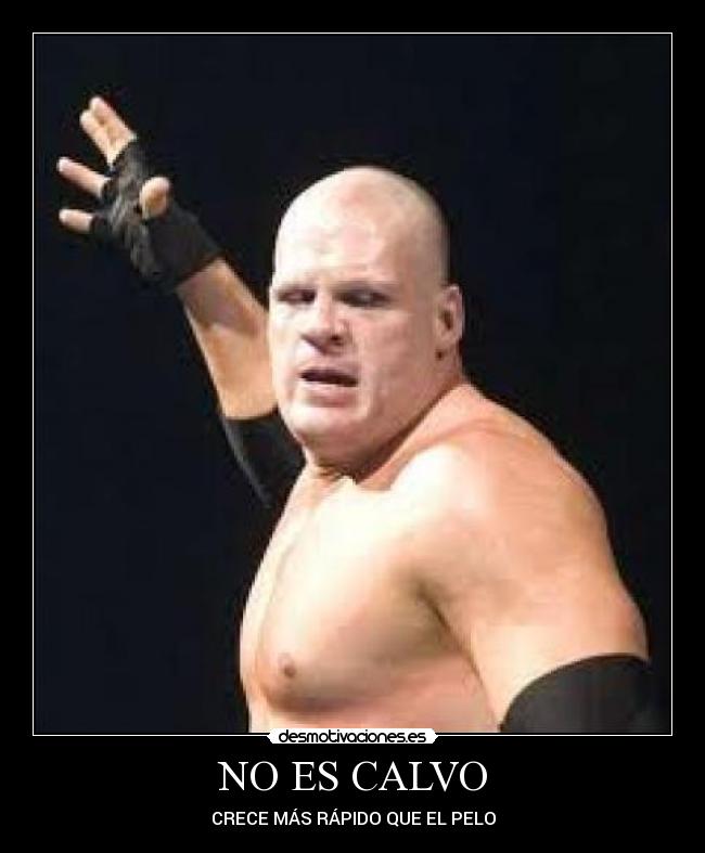 NO ES CALVO - CRECE MÁS RÁPIDO QUE EL PELO