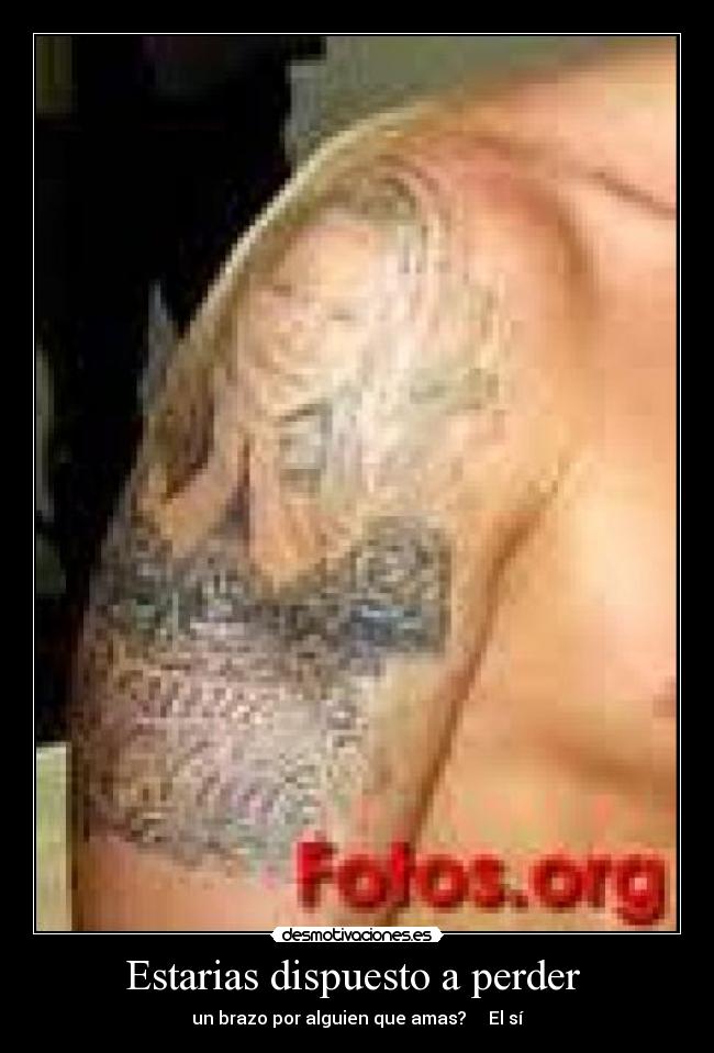 Estarias dispuesto a perder  - un brazo por alguien que amas?     El sí