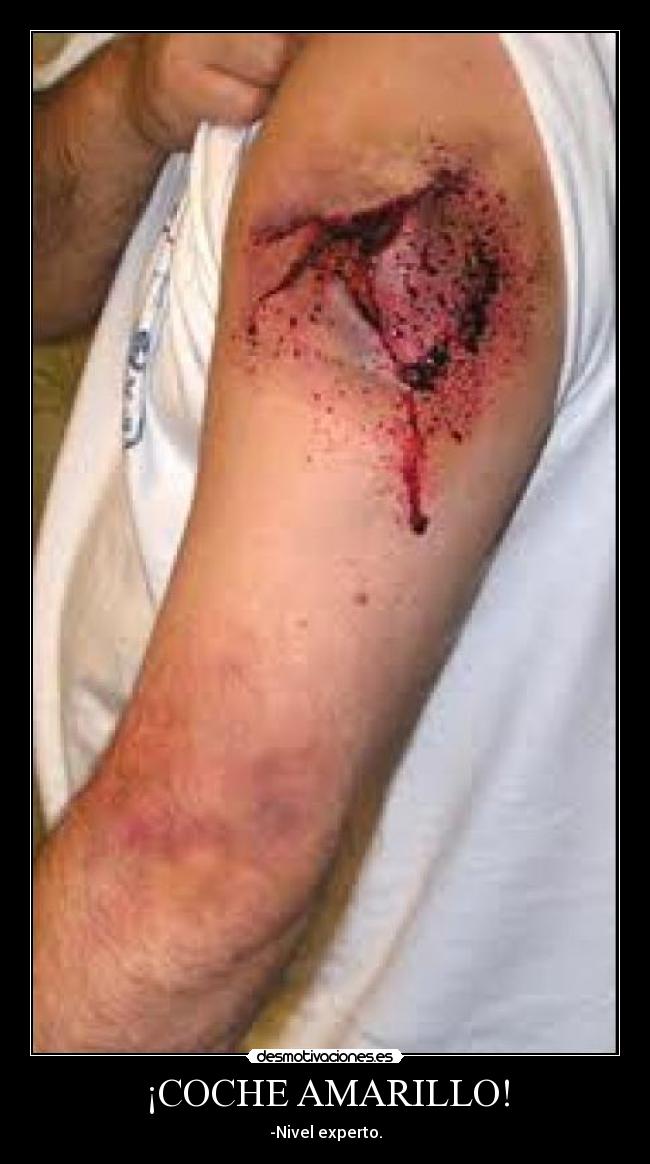¡COCHE AMARILLO! -