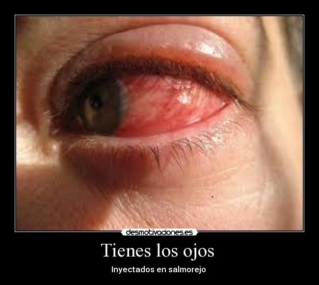 Tienes los ojos - Inyectados en salmorejo