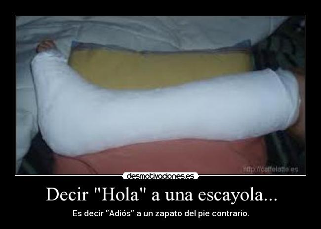 Decir Hola a una escayola... -