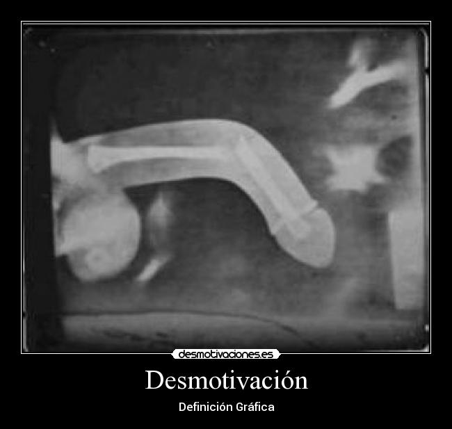 Desmotivación -