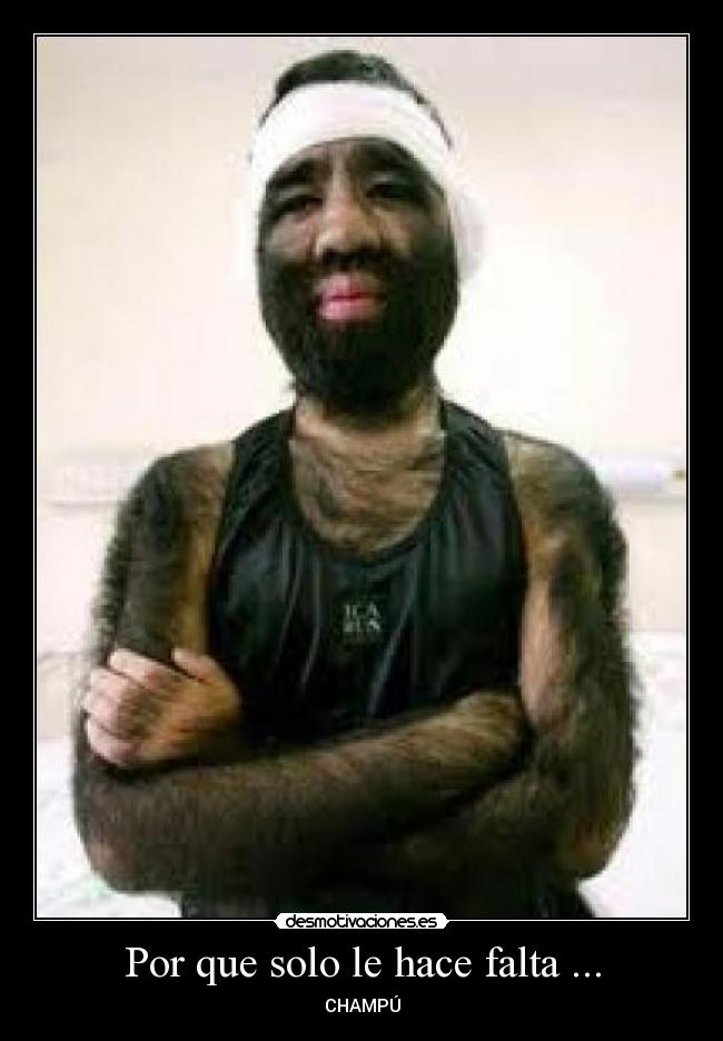 Por que solo le hace falta ... - CHAMPÚ