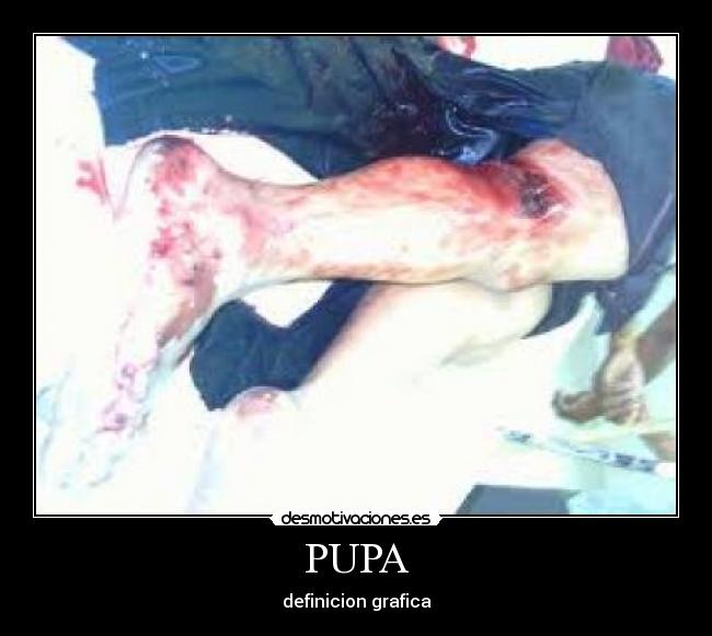 PUPA - definicion grafica
