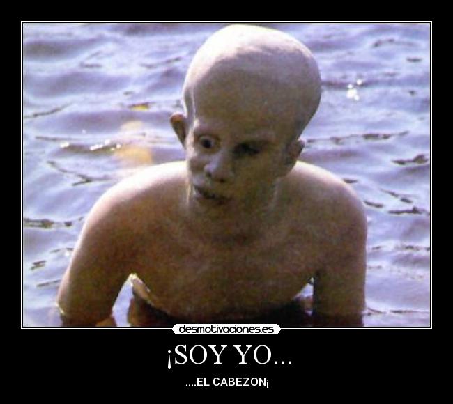¡SOY YO... - ....EL CABEZON¡