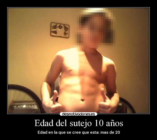 Edad del sutejo 10 años -