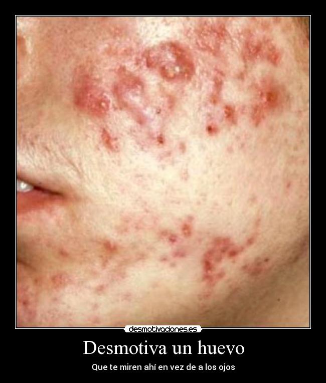 Desmotiva un huevo - Que te miren ahí en vez de a los ojos