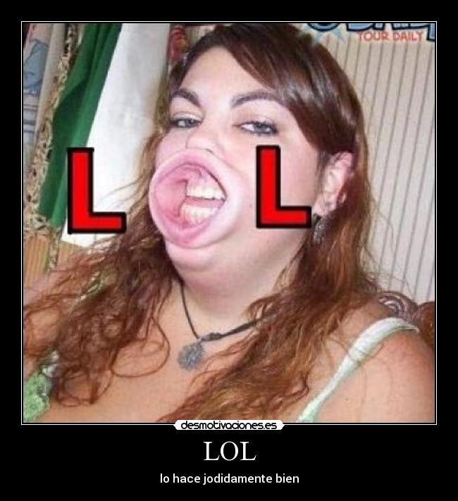 LOL -