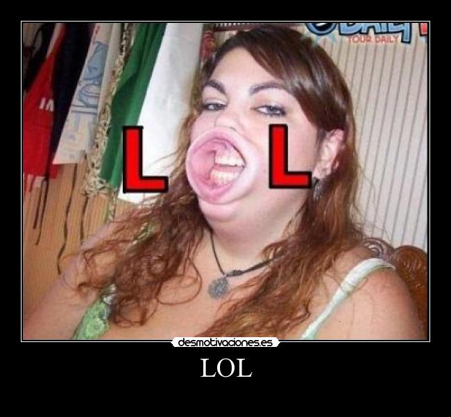 LOL -