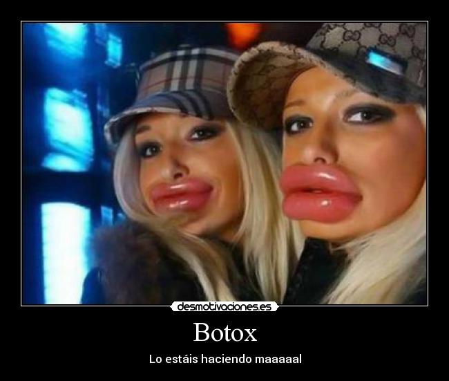 Botox - Lo estáis haciendo maaaaal