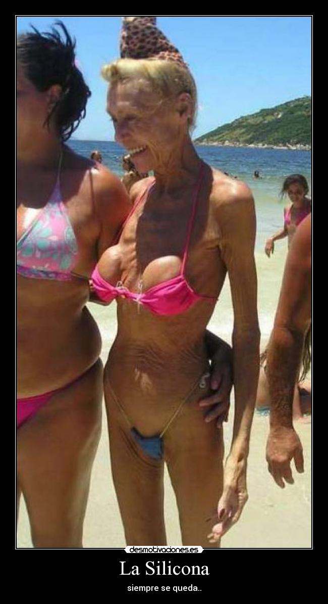 La Silicona - siempre se queda..