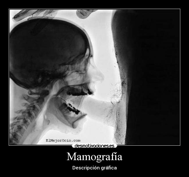 Mamografía - 