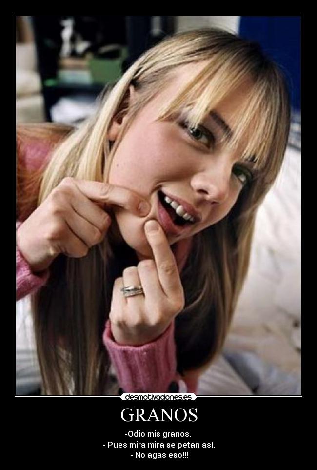 GRANOS - -Odio mis granos. 
- Pues mira mira se petan así.
- No agas eso!!!