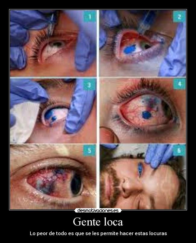 Gente loca -