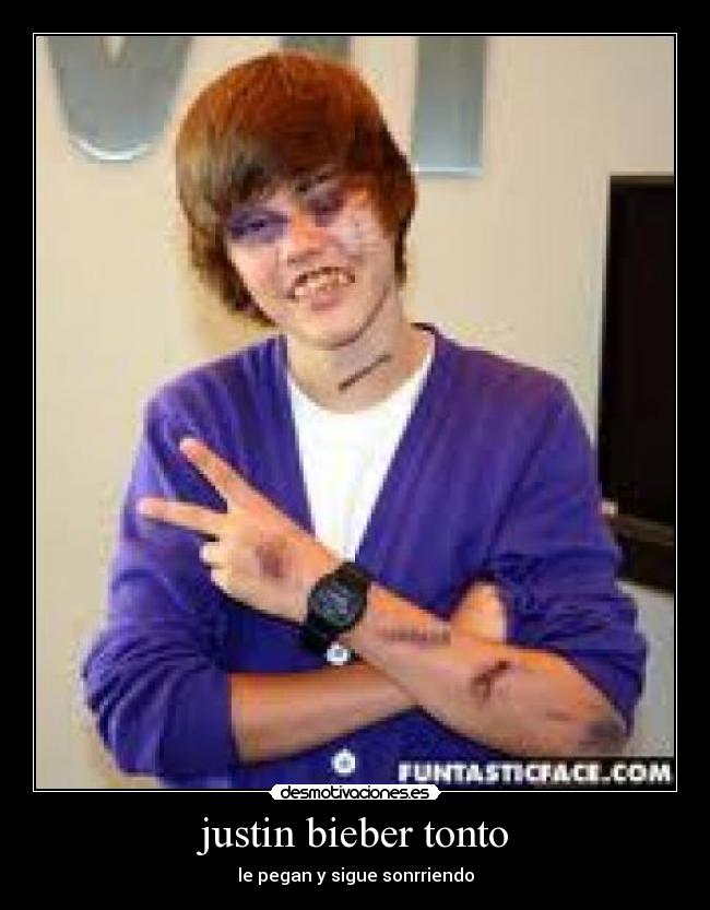 justin bieber tonto - le pegan y sigue sonrriendo
