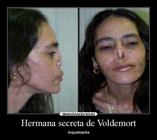 Hermana secreta de Voldemort - 