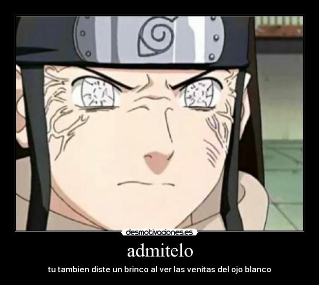 admitelo - tu tambien diste un brinco al ver las venitas del ojo blanco