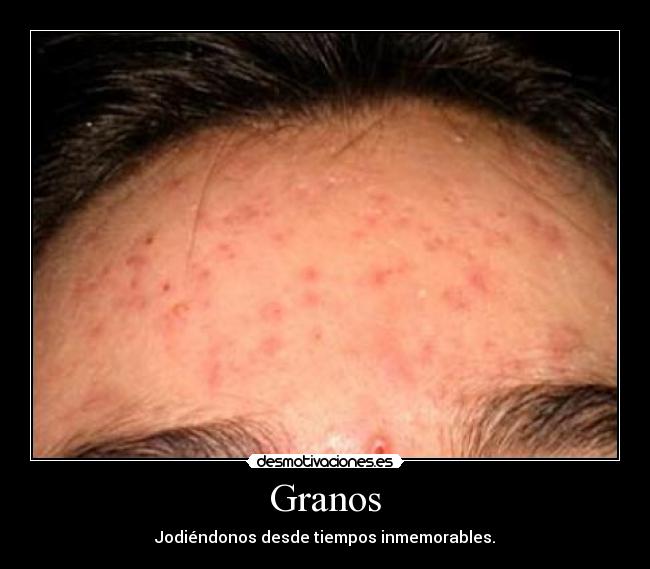 Granos -