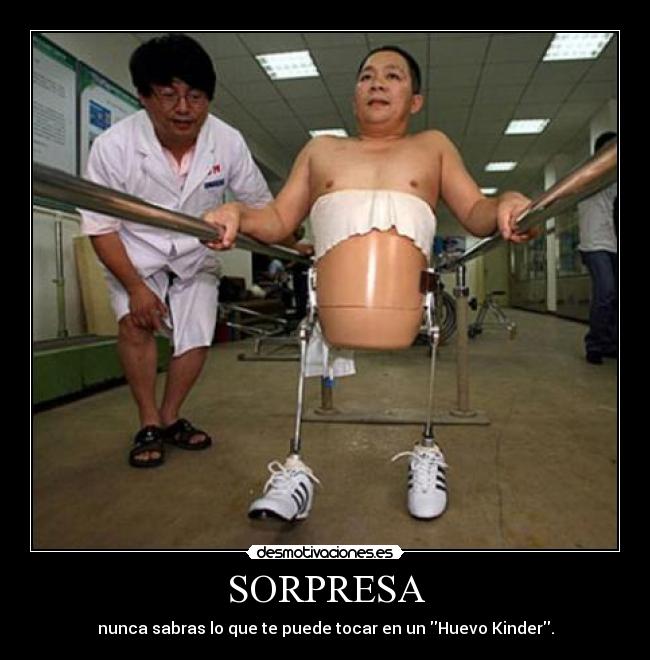 SORPRESA - 