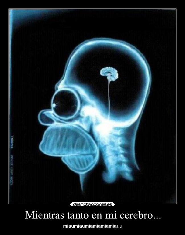 Mientras tanto en mi cerebro... - miaumiaumiamiamiamiauu