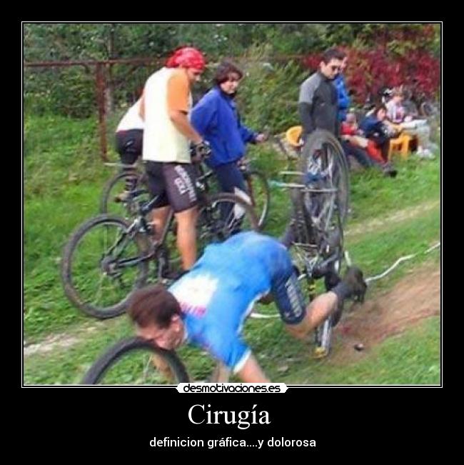 Cirugía - definicion gráfica....y dolorosa