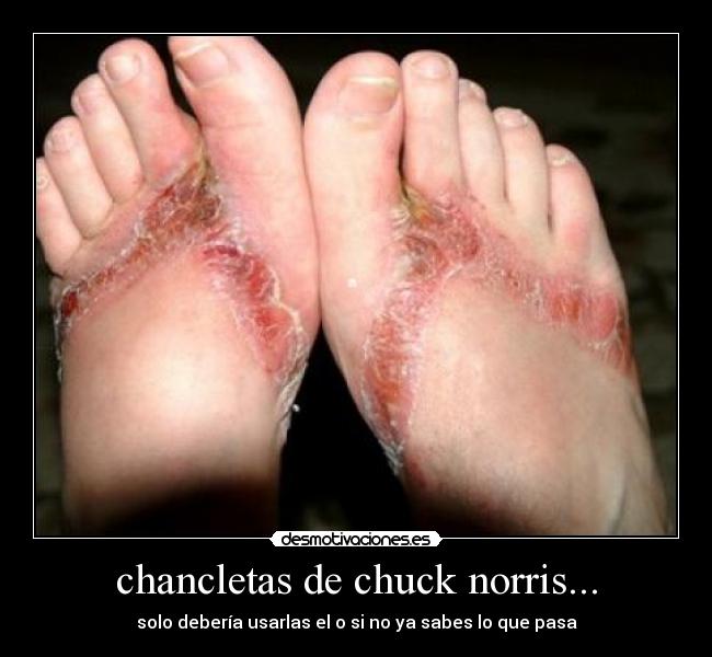 chancletas de chuck norris... - 