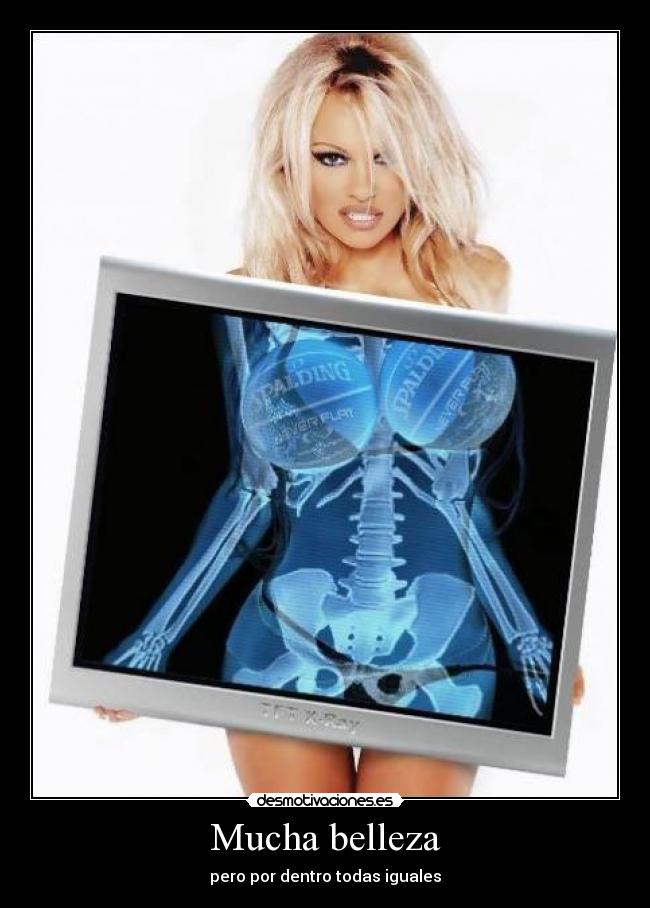 Mucha belleza - pero por dentro todas iguales