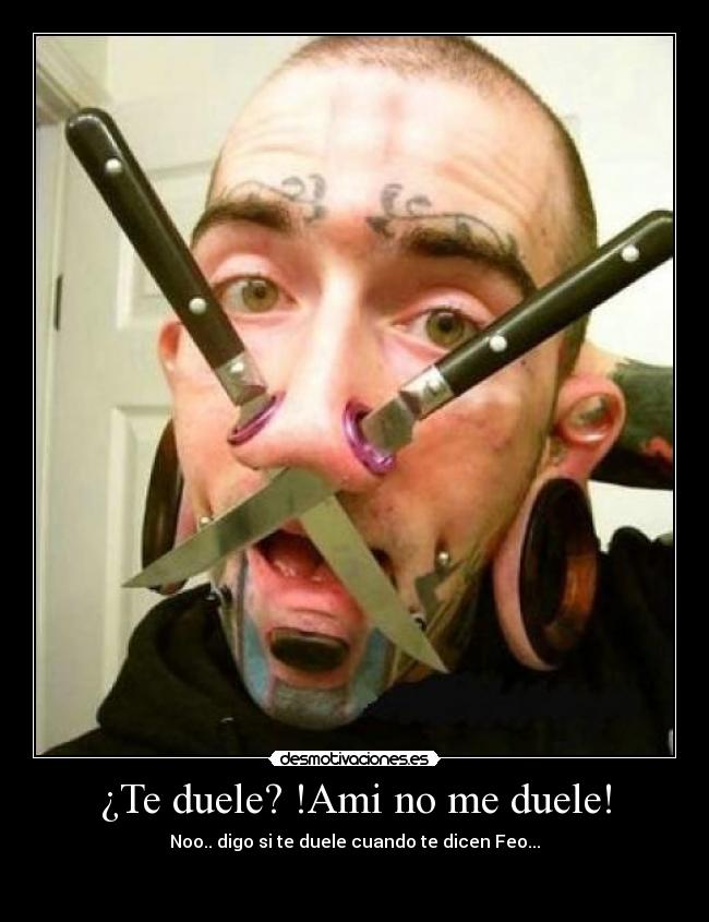 ¿Te duele? !Ami no me duele! - Noo.. digo si te duele cuando te dicen Feo...