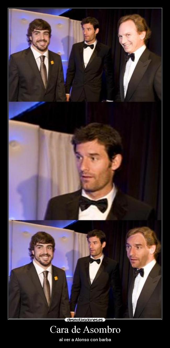 Cara de Asombro - al ver a Alonso con barba