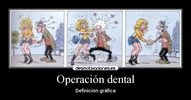 Operación dental - Definición gráfica