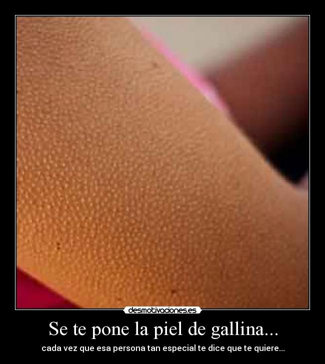 Se te pone la piel de gallina... - 