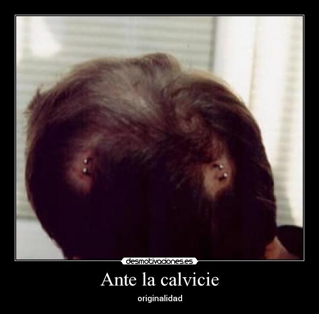 Ante la calvicie - originalidad
